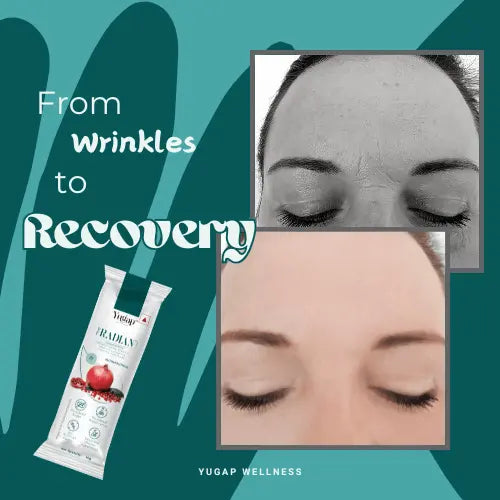 Wrinkles to Recovery: Exploring the Full Benefits of Collagen Blends - YuGap Wellness